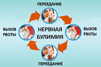 Лечение булимии в Сортавале